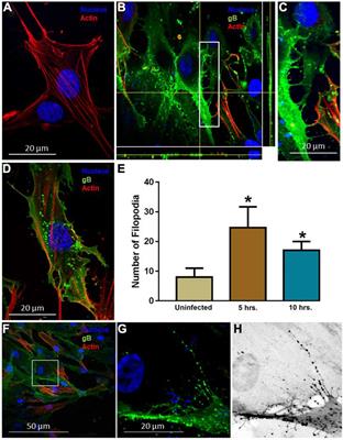 Induction of Filopodia During Cytomegalovirus Entry Into Human Iris Stromal Cells